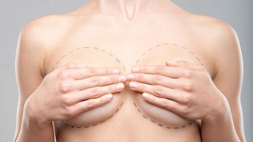 Mga tampok ng Operational Breast Awards