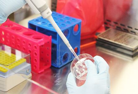 Pagsusuri ng mga pagsubok ng pasyente bago magsagawa ng pagpapalaki ng mammoplasty